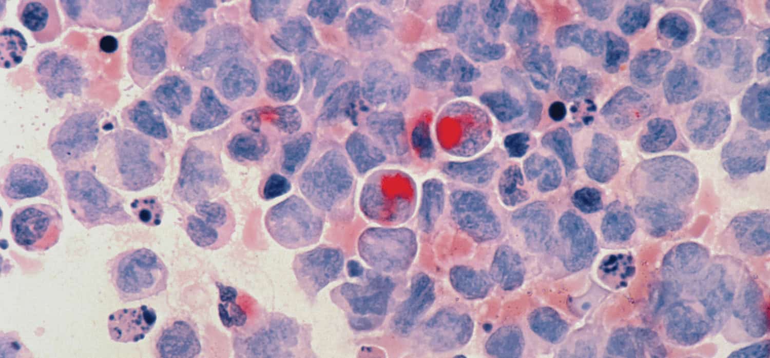 Treating incurable diseases with bacteria-generated molecules