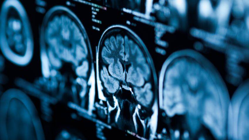 Making MRI scans more accessible