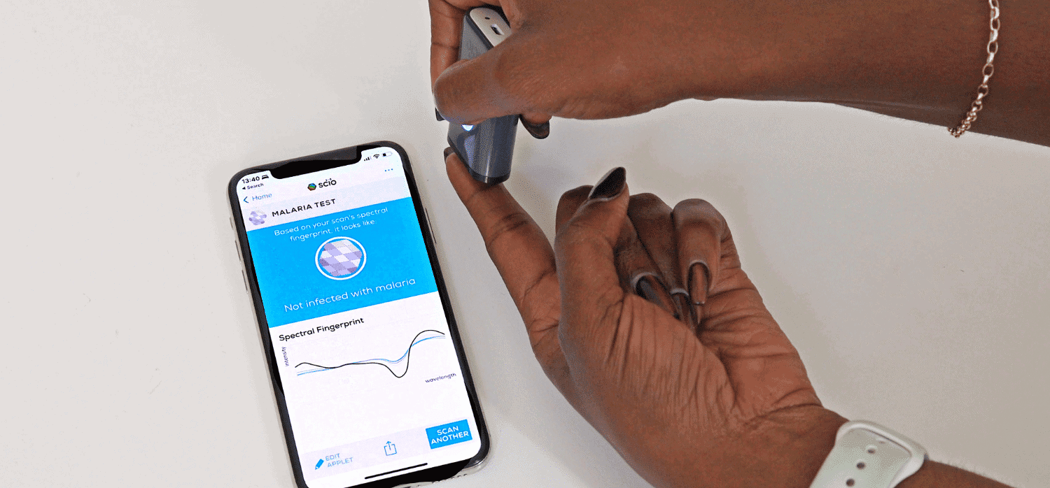 Detecting malaria through a smartphone